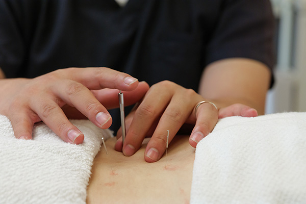 当グループの生理不順施術について